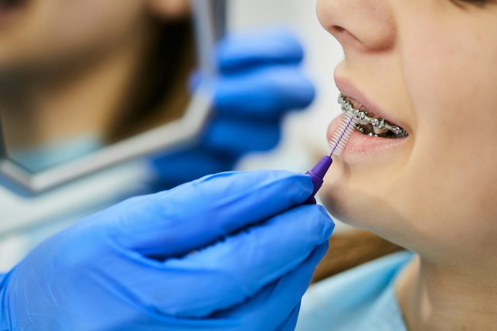 Close-up of dentist using interdental brush and cleaning dental braces of teenage girl..